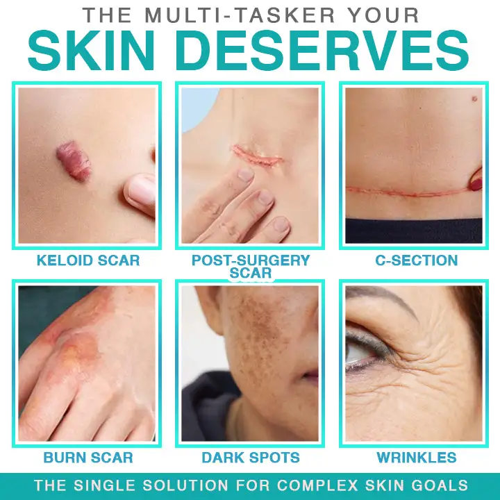 Patch de soin pour micro-aiguilles BBOJI® 3 en 1 – Image 3