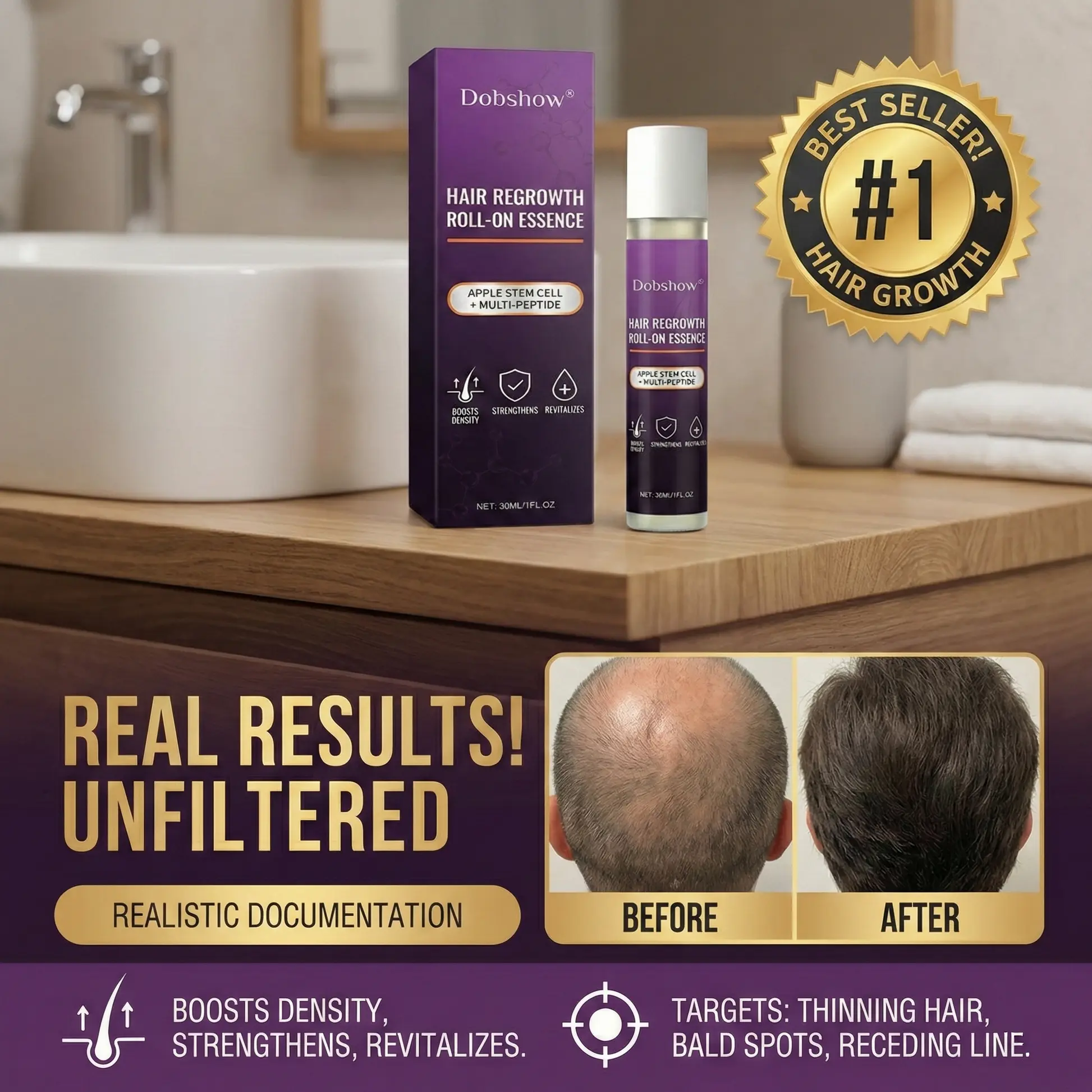 Essence roll-on de soin pour la repousse des cheveux Dobshow® – Image 2