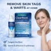 Spray de traitement cryogénique Velnix® ClearRoot