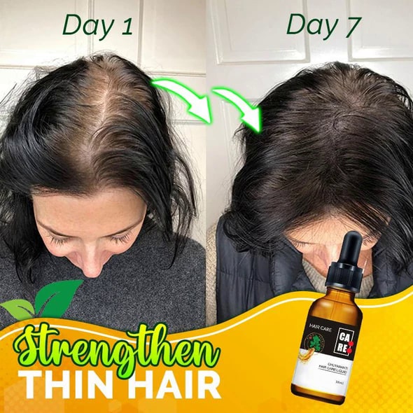 Sérum capillaire fort 10X-Regro