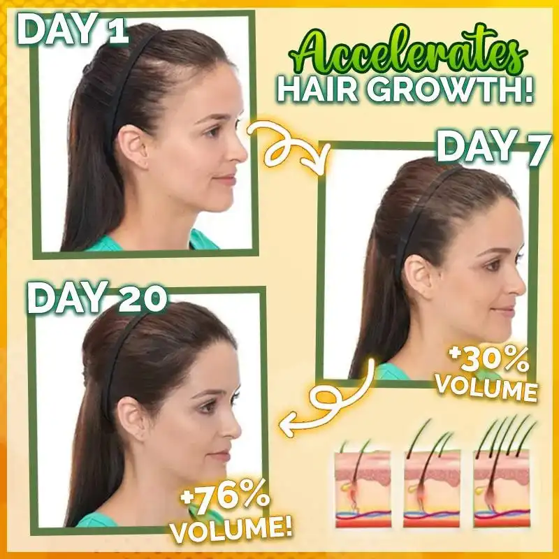 Sérum capillaire fort 10X-Regro – Image 2