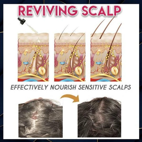 Essence de croissance des cheveux Pure Grow – Image 2