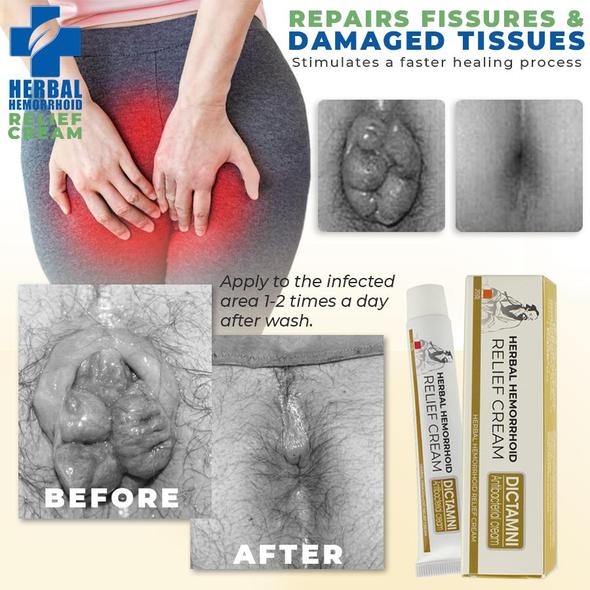 Pommade de traitement des hémorroïdes Hemorelief – Image 3
