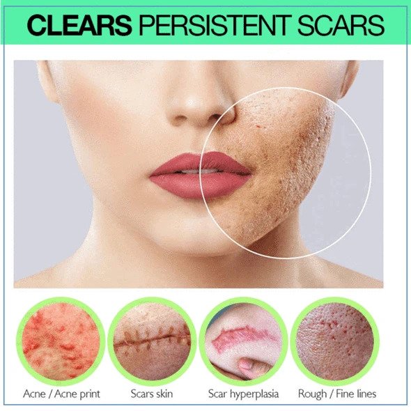 Sérum anti-cicatrices PRO Niacinamide – Image 3