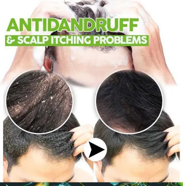 Solution assombrissante pour cheveux bio – Image 2