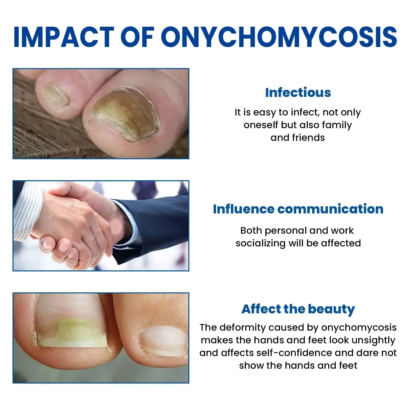 Patchs de réparation des ongles contre les champignons – Image 2