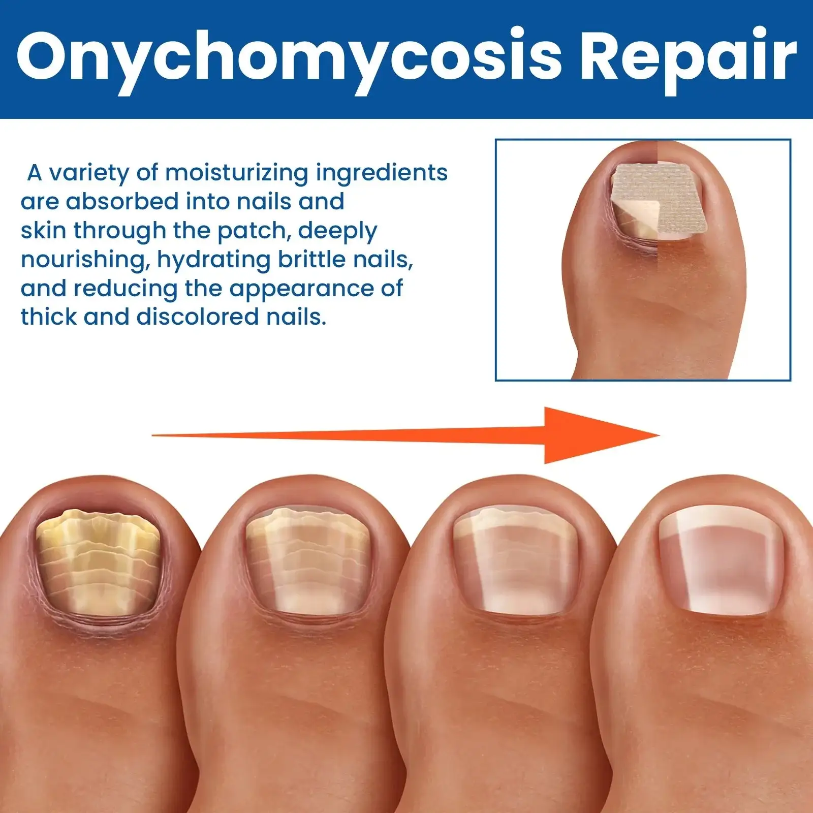 Patchs de réparation des ongles contre les champignons – Image 4