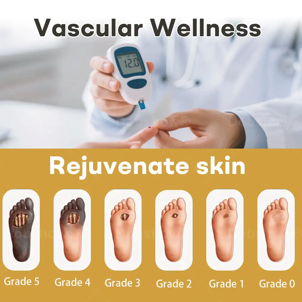 Spray pour plaies au venin d'abeille GlucoShield – Image 2