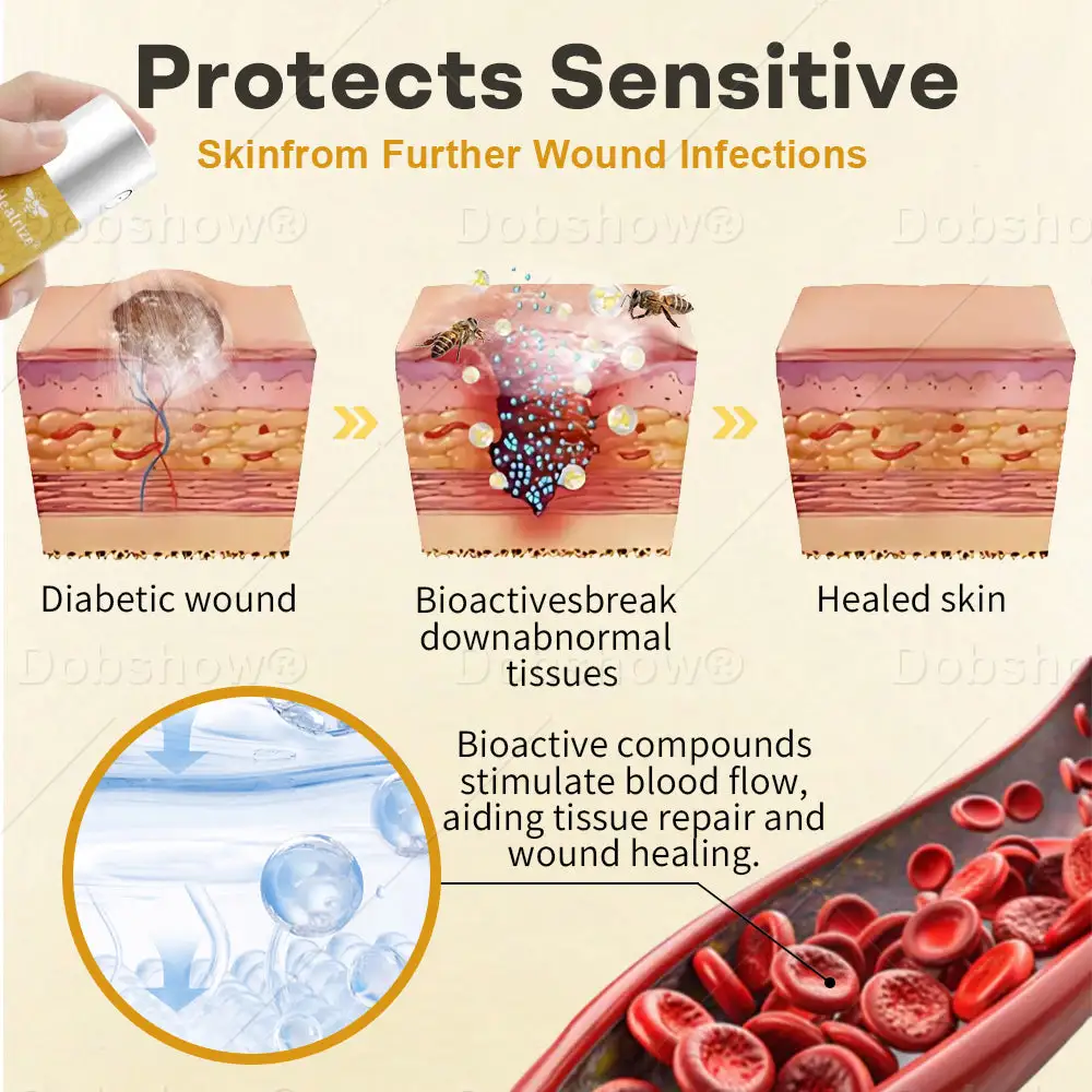 Spray pour plaies au venin d'abeille GlucoShield – Image 3