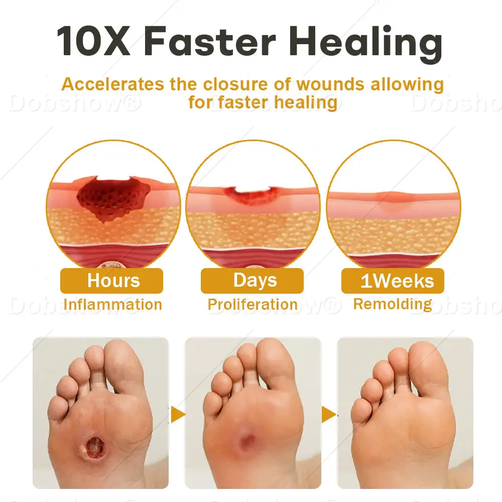 Spray pour plaies au venin d'abeille GlucoShield – Image 4