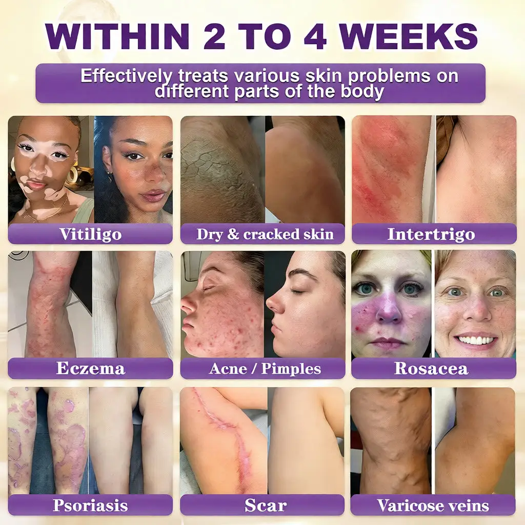 Crème de restauration de la peau 10 en 1 à la biotine – Image 2