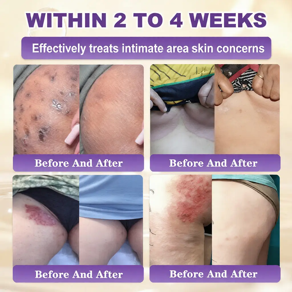 Crème de restauration de la peau 10 en 1 à la biotine – Image 4