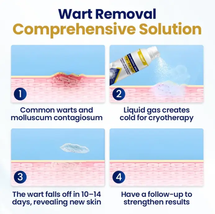 Spray régénérateur de bosses Chillique – Image 3